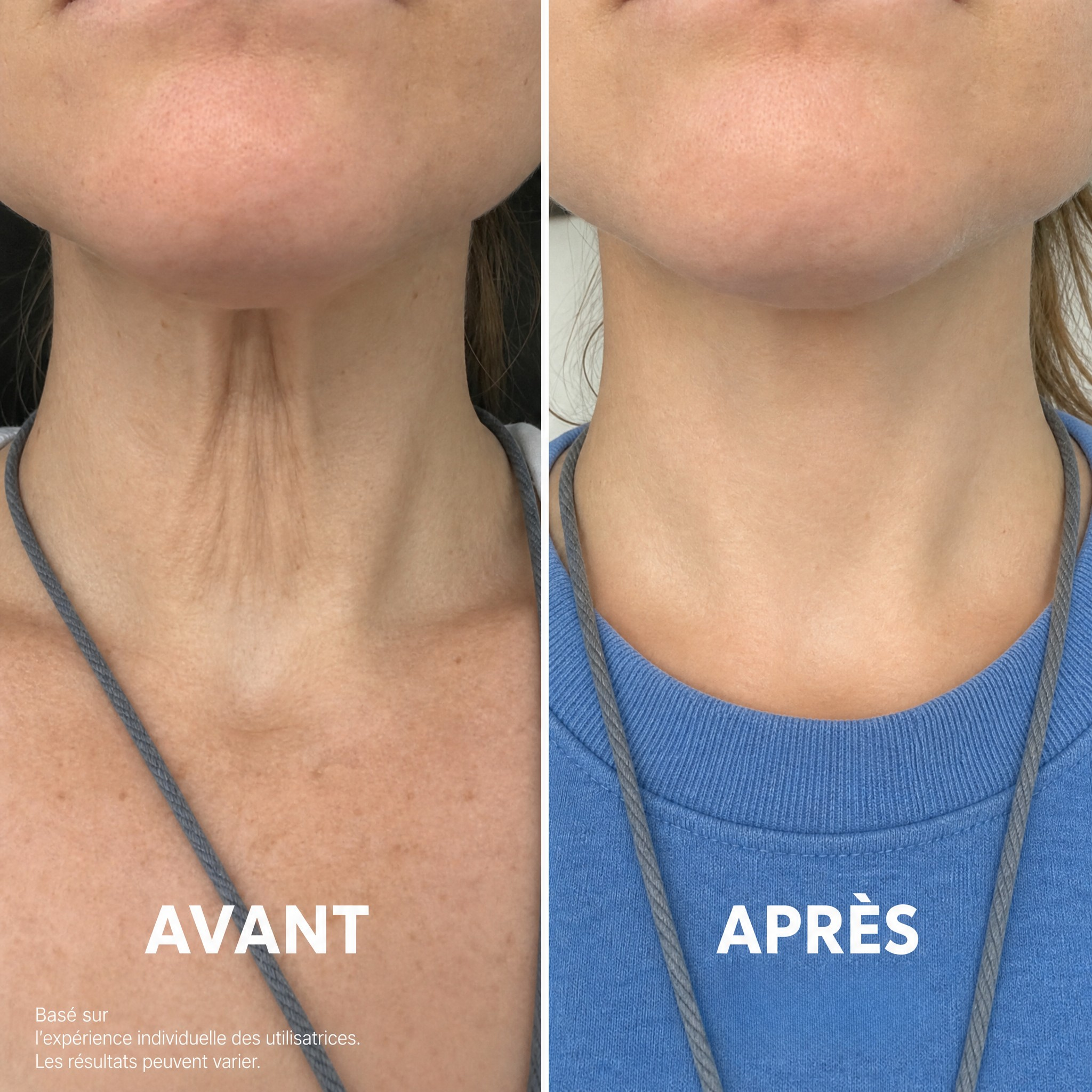 Ondéa® Crème Cou Raffermissante
