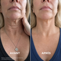 Ondéa® Crème Cou Raffermissante