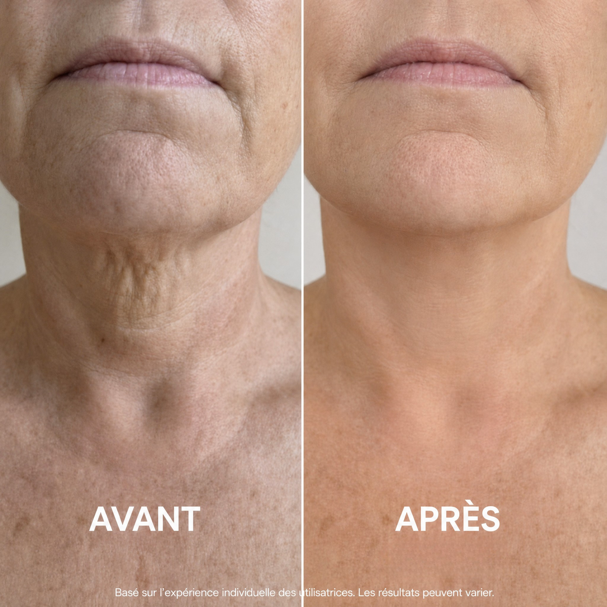 Ondéa® Crème Cou Raffermissante