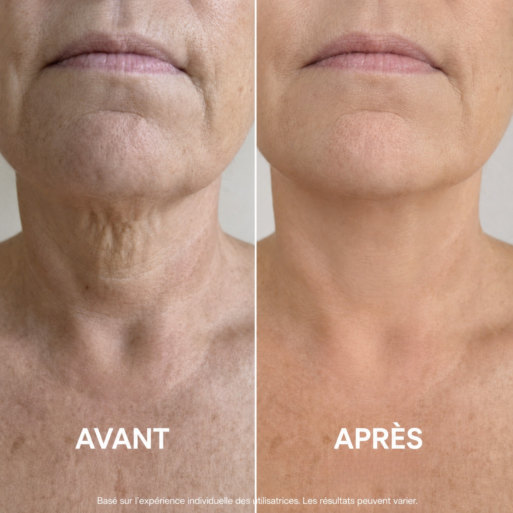 Ondéa® Crème Cou Raffermissante