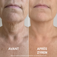 Ondéa® Crème Cou Raffermissante